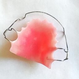 Hawleys removable type of retainer