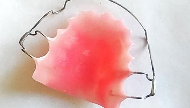 Hawleys removable type of retainer