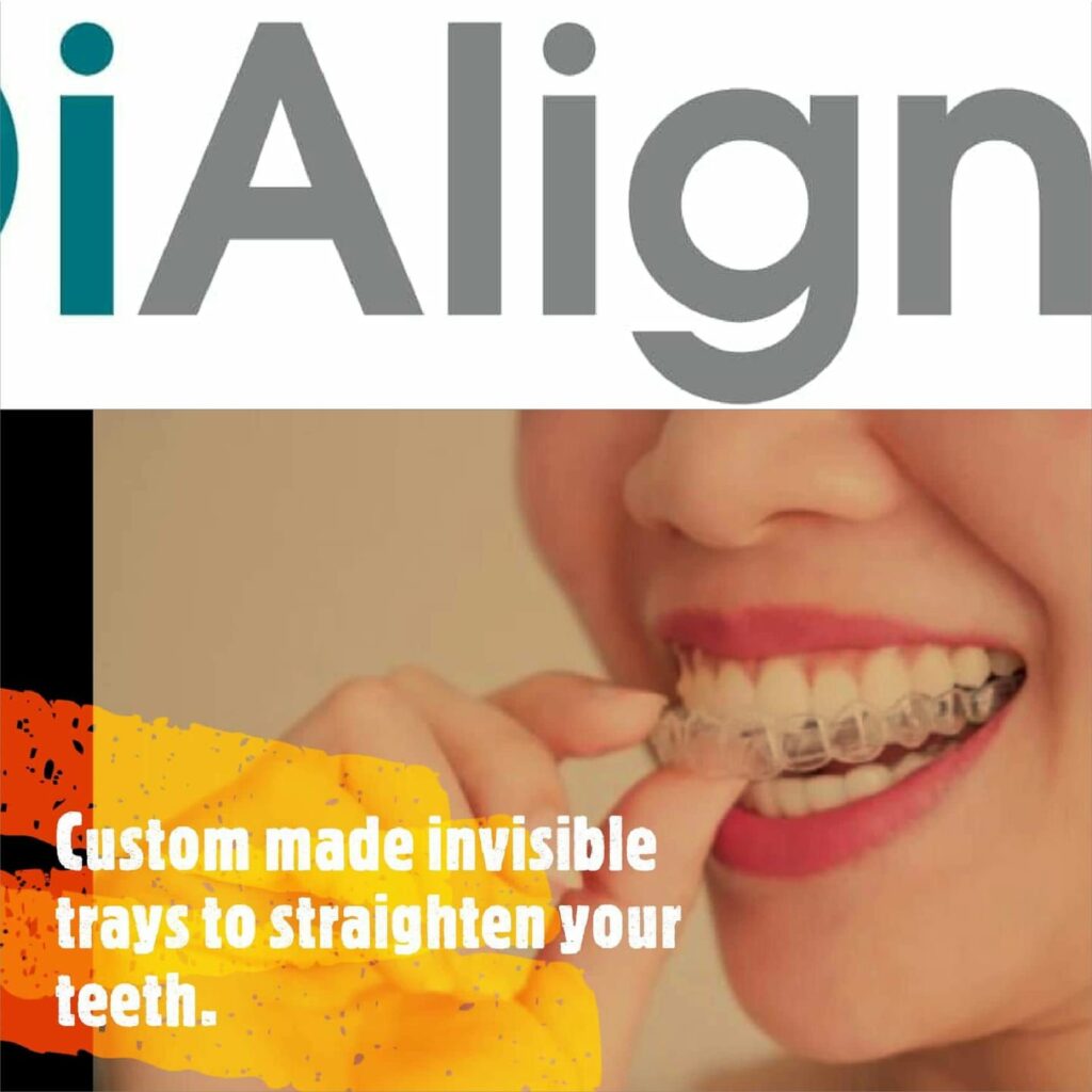 aligners in Kathmandu Nepal