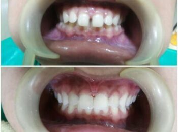 Dental Clinic In Kathmandu