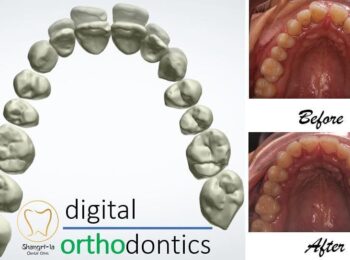 Digital Dentistry