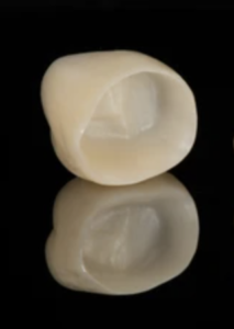 Porcelain dental crown