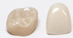 zirconia crown
